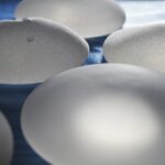 Comment choisir entre un lipofilling mammaire et une augmentation mammaire par prothèses ?